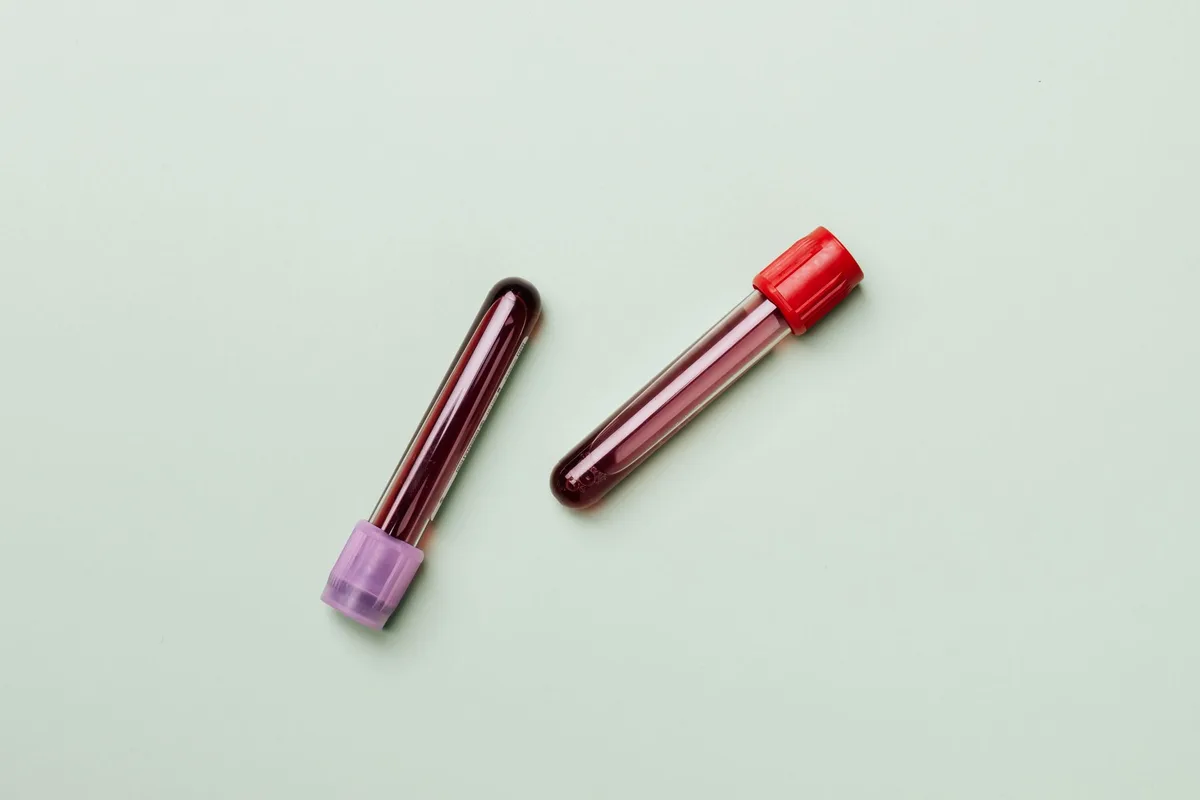 Dos tubos de muestra de sangre