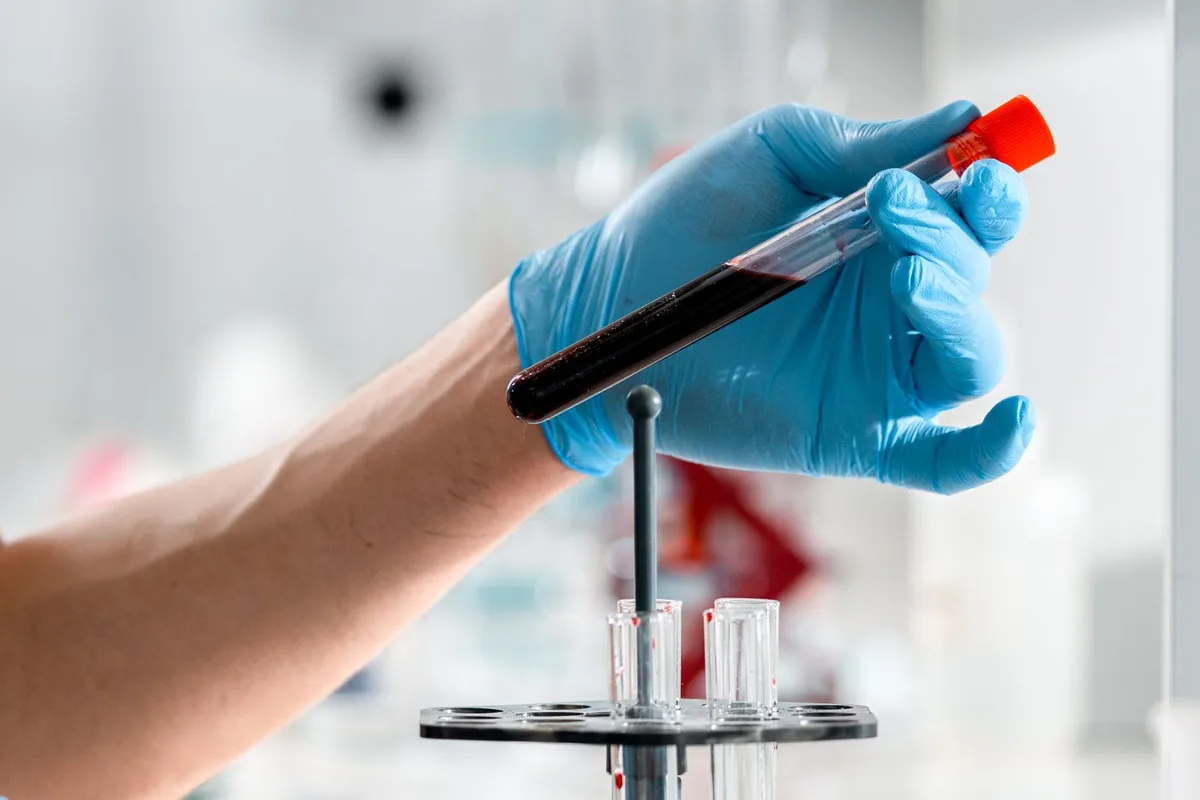 Tubo con una muestra de sangre en un laboratorio