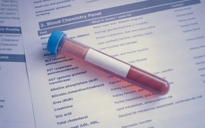 Tubo de sangre sobre una hoja de examen con el perfil de lípidos